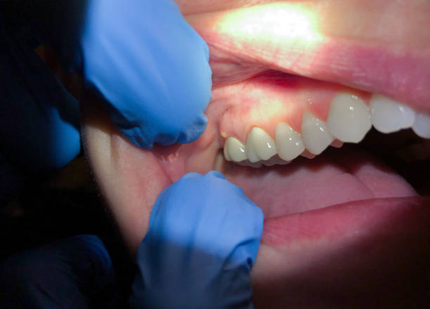 Best Emergency Dental Surgery in Arcanum, OH