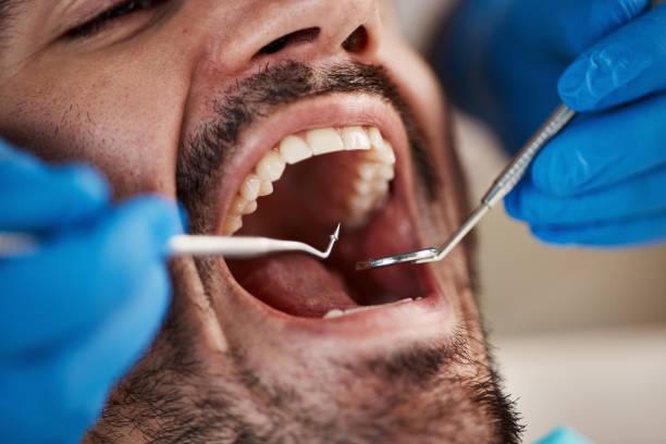 Best Emergency Dental Care for Trauma or Injury in Arcanum, OH
